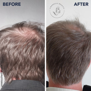 قرص ضدریزش مو فیتو 120 عددی مدل 4mois 