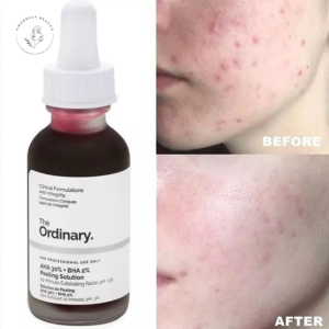 سرم لایه ‎بردار پیلینیگ AHA + BHA اوردینری حجم 30 میل