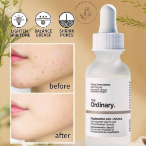 سرم ضد جوش و روشن کننده نیاسینامید 10% + زینک 1% اوردینری 30 میل