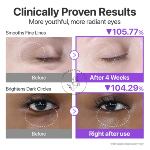 کرم دورچشم جوانساز و ضدچروک نامبوزین شماره 9 حاوی رتینول حجم 10 میل