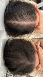 قرص ضدریزش مو فیتو 84 عددی مدل Phytocyane