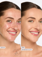 کانسیلر تارت مدل Shape Tape